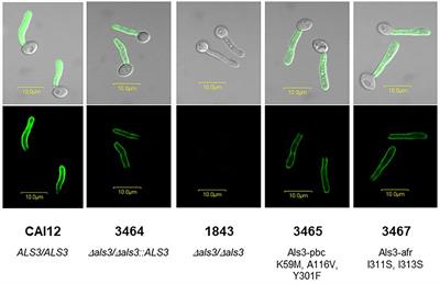 Assessing Als3 Peptide-Binding Cavity and Amyloid-Forming Region Contributions to Candida albicans Invasion of Human Oropharyngeal Epithelial Cells